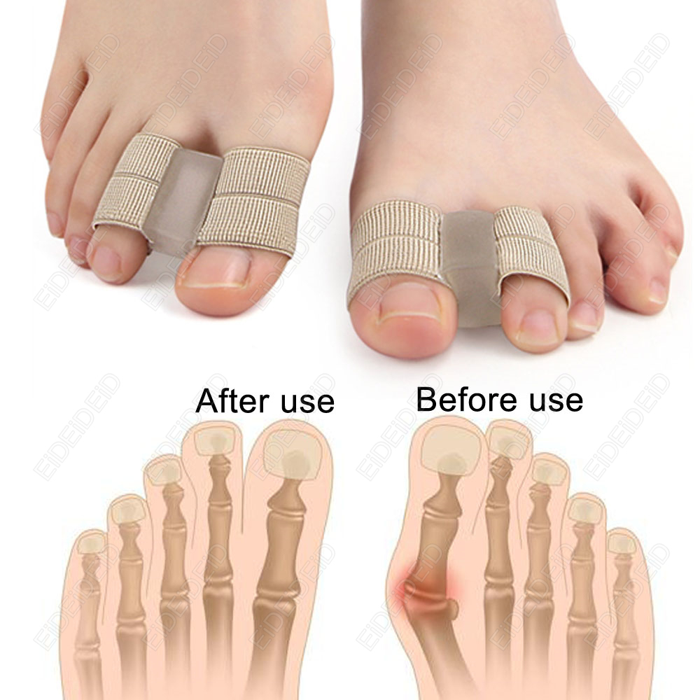 Bunion teen Corrector Orthesen - Women'S Shoes With Bunions recensie en prijs